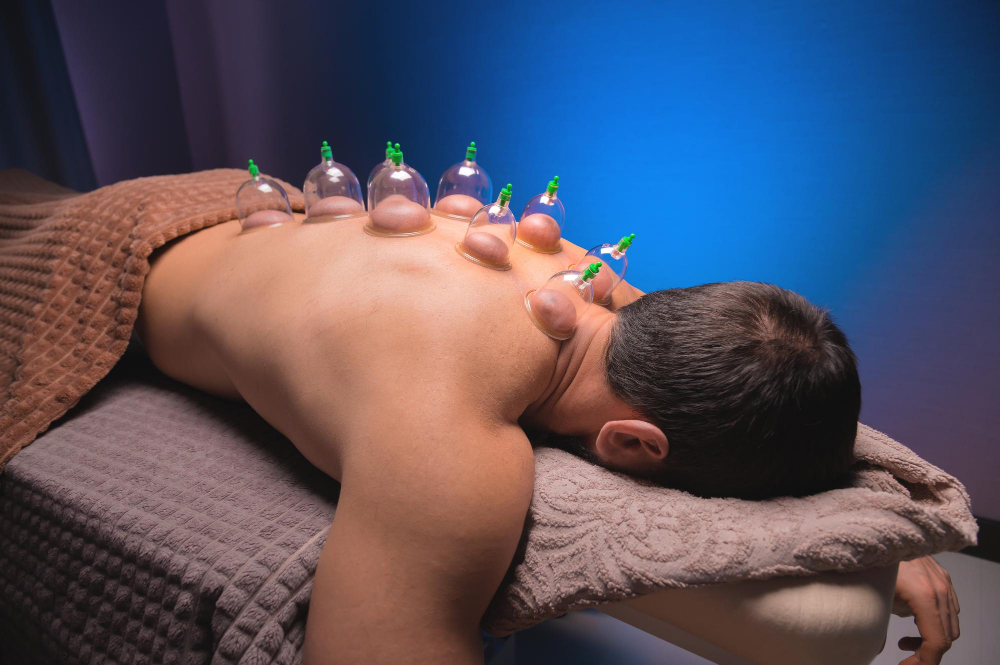 Acupuncture 30mins+Massage 30mins+Cupping