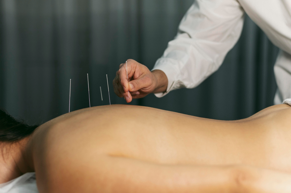 Acupuncture & Herbs