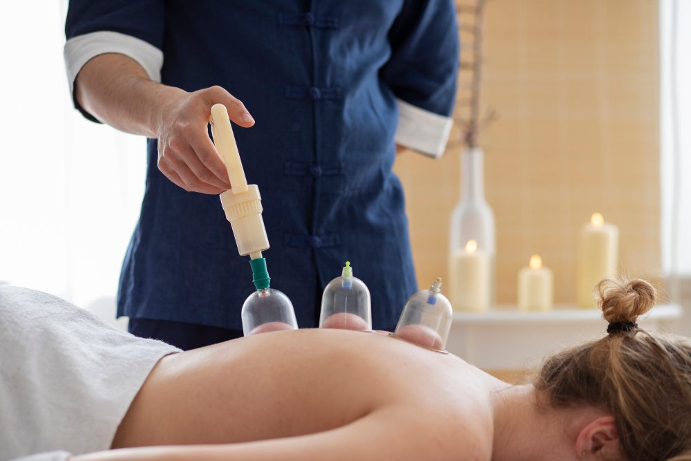 cupping therapy