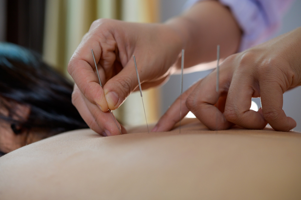 Acupuncture Herbal